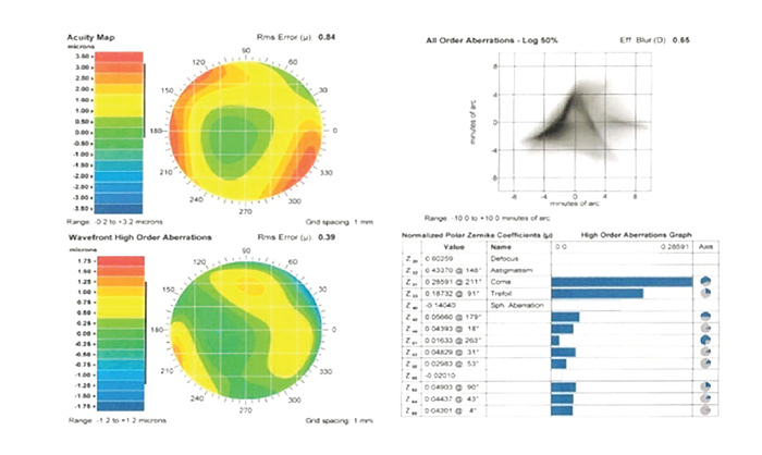 Variable Spot Scanning